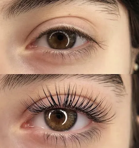 7 - Laser and Beauty by Nina