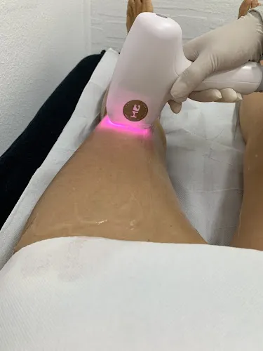8 - Laser Haarentfernung Augsburg by Sonya Tahan since 2006