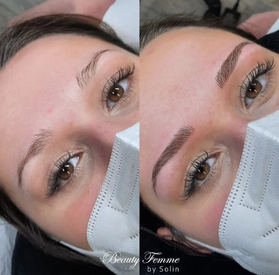 1 - Laser Plus Beauty Center by Batoul