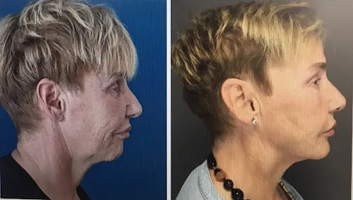 3 - Lenormand Jennifer