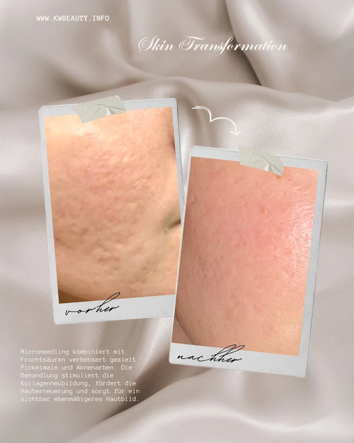 1 - LeO Nails Nagelstudio