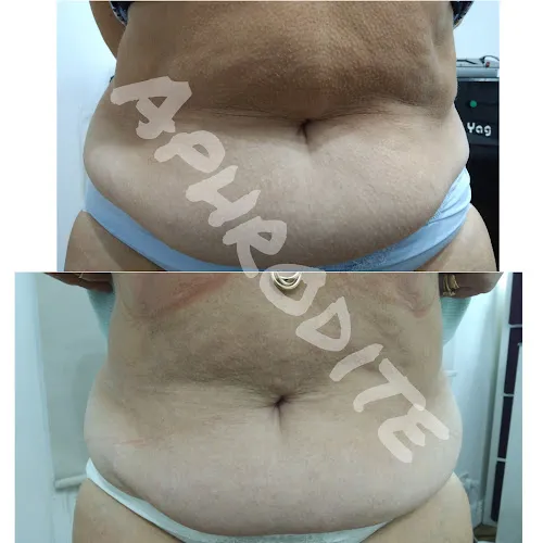 2 - Lily Nails & Foot Spa