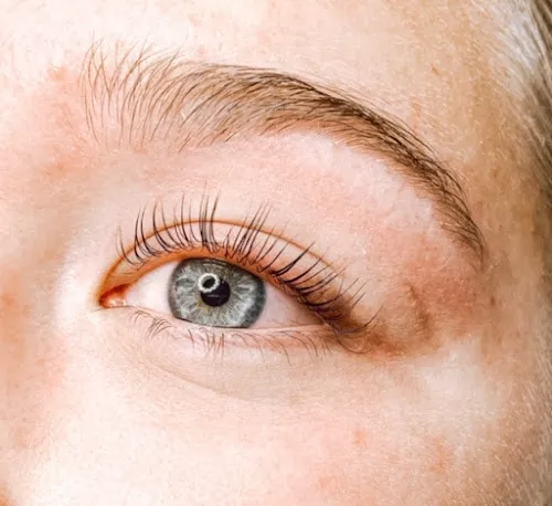 7 - Lueur Clinic Utrecht