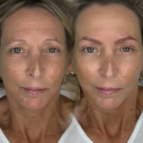 5 - Mbrows Permanent make up Cahir