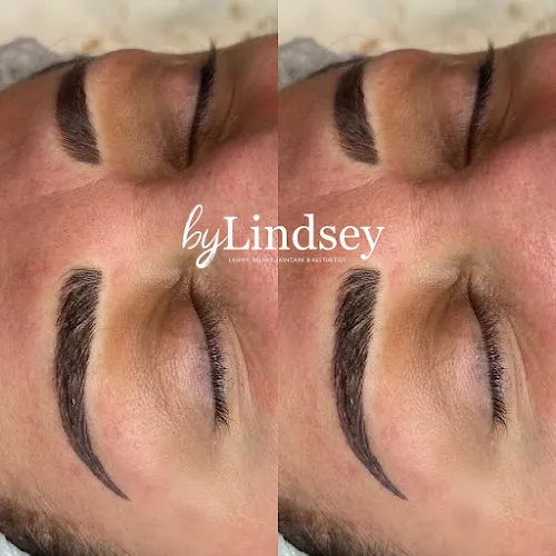 5 - Medispa Bylindsey