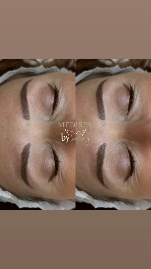 1 - Medispa Bylindsey