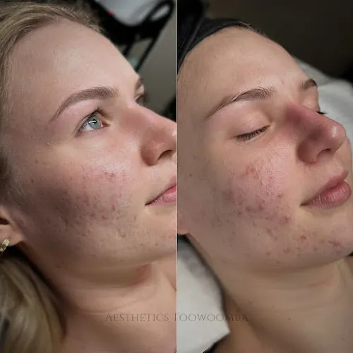 8 - Mestiza Beauty By Ashley