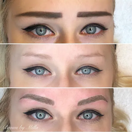 5 - Milla - Mi Clinic Gävle