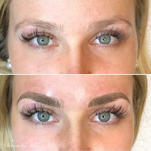 4 - Milla - Mi Clinic Gävle