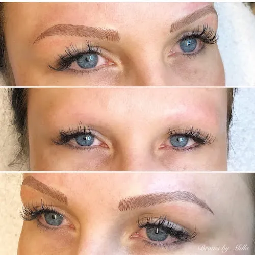 1 - Milla - Mi Clinic Gävle