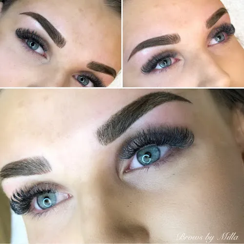 3 - Milla - Mi Clinic Gävle