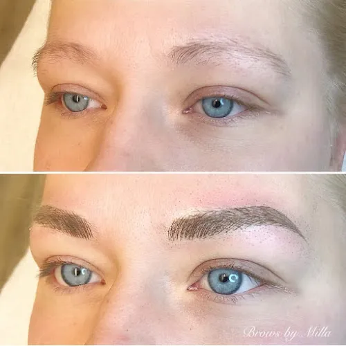 2 - Milla - Mi Clinic Gävle