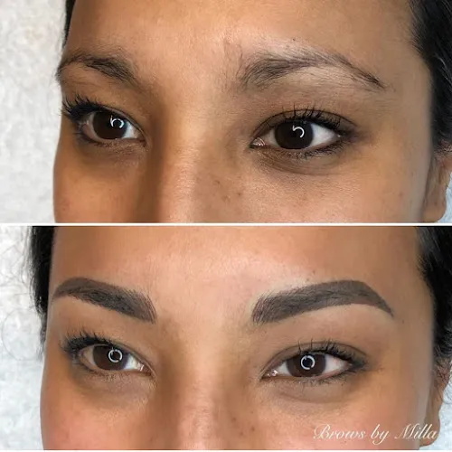 6 - Milla - Mi Clinic Gävle