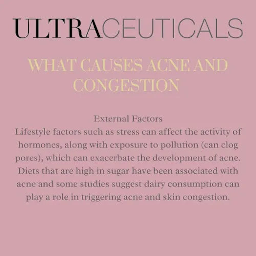 3 - Mint escape for Hair