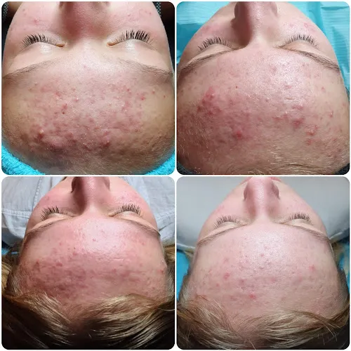 6 - Nagelsalon Liana - Emmen