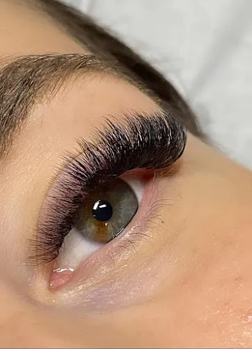 8 - Nevaeh Loren Aesthetics Nottingham & Mansfield