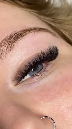 5 - Nevaeh Loren Aesthetics Nottingham & Mansfield