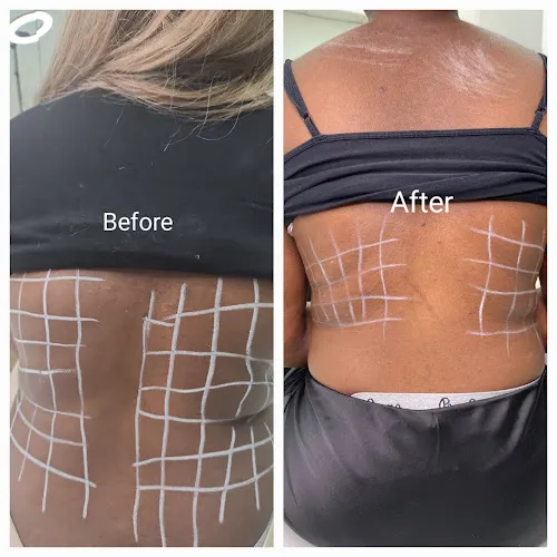 7 - Noire Aesthetics Clinic