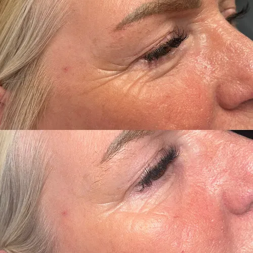 2 - Norfolk Aesthetics