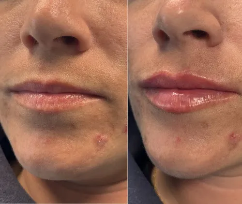 3 - Norfolk Aesthetics