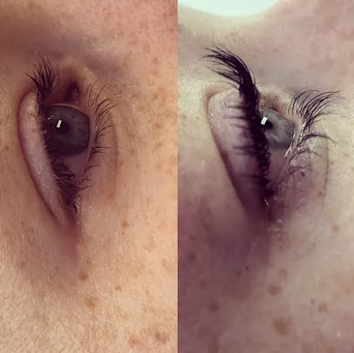 3 - Noura Beauty Center - نورا بيوتي سنتر