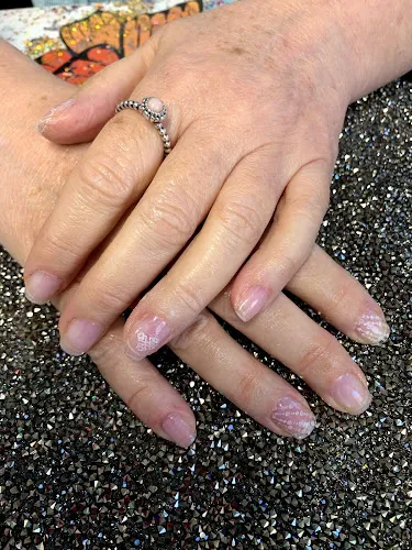 5 - Prescription Nails By Kiwi Delights