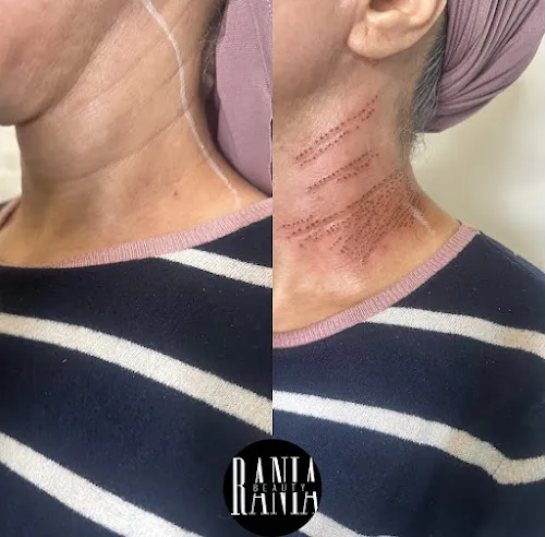 5 - Rania Beauty