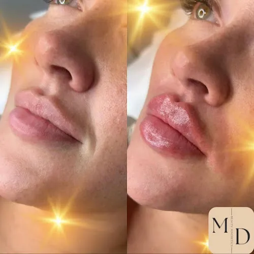 2 - Razors Edge Barbers