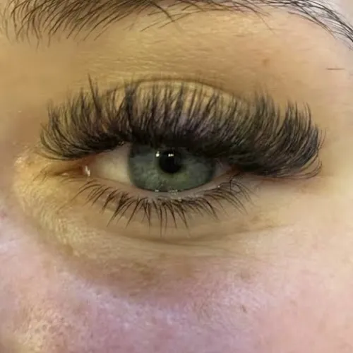 3 - Reyezuelo Beauty and Aesthetics