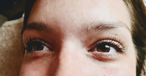 5 - Rosies Aesthetics