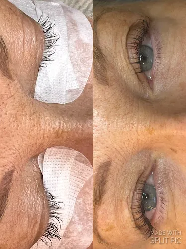 2 - Rupis Clinic - Hair, Beauty, Aesthetics