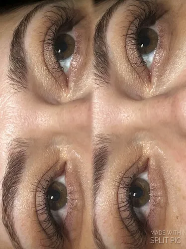 3 - Rupis Clinic - Hair, Beauty, Aesthetics