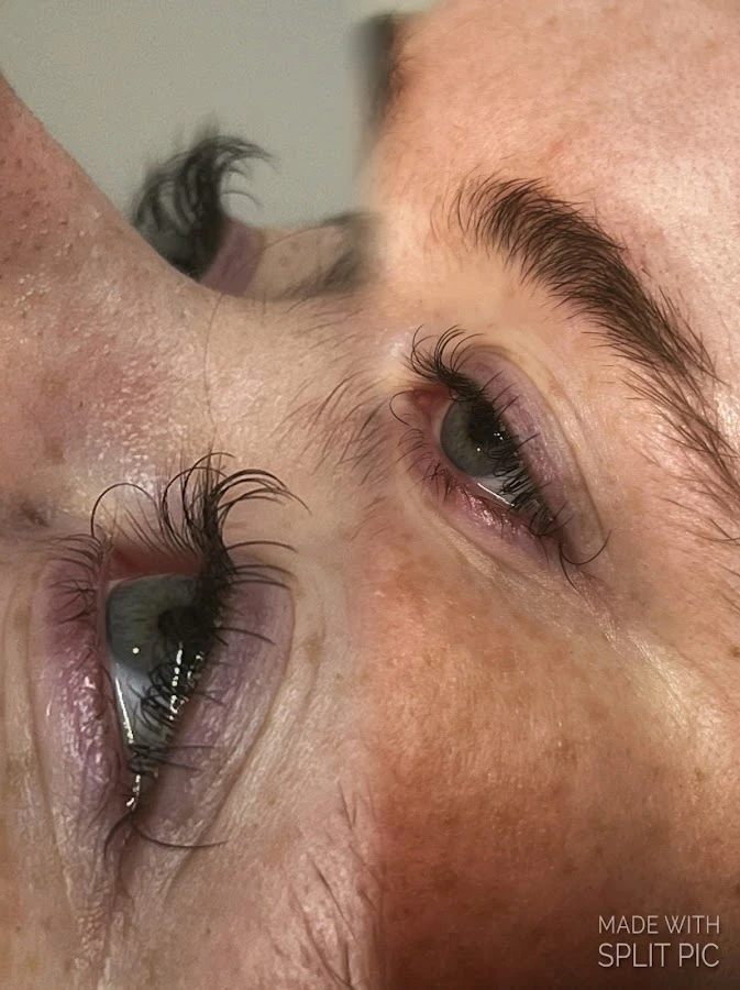 1 - Rupis Clinic - Hair, Beauty, Aesthetics