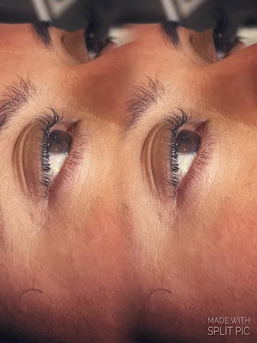 6 - Rupis Clinic - Hair, Beauty, Aesthetics