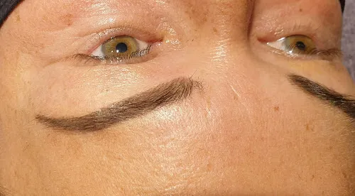 6 - Schönheitswerk / Lindau