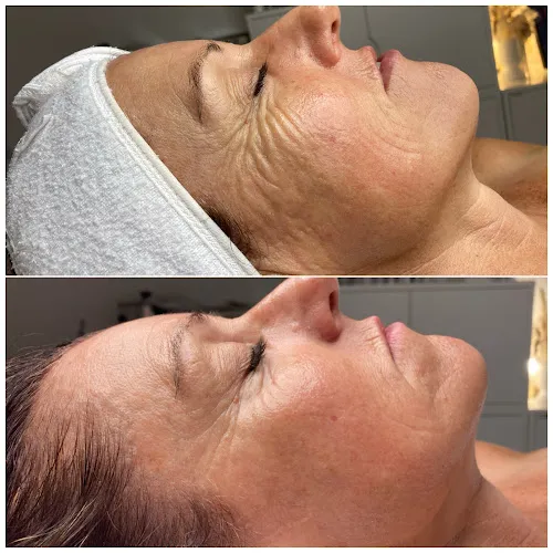 2 - Skin Deep Perfection