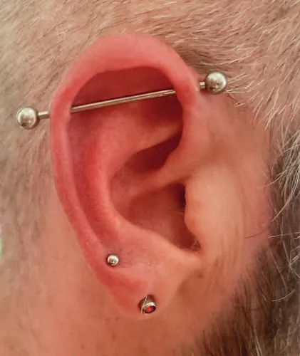 6 - The Needles Kiss