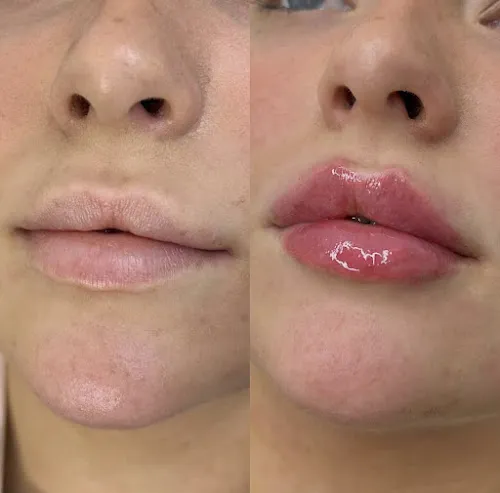 6 - TheBeautySpotHarrogate