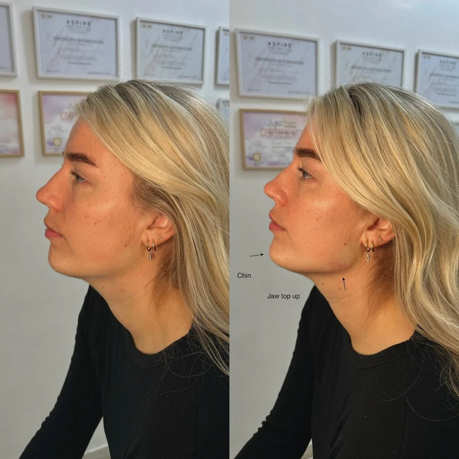 1 - TheBeautySpotHarrogate