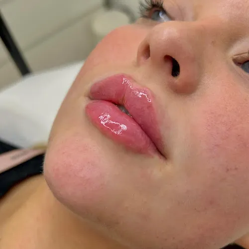 3 - TheBeautySpotHarrogate