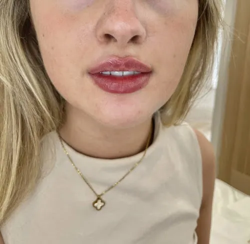 5 - TheBeautySpotHarrogate