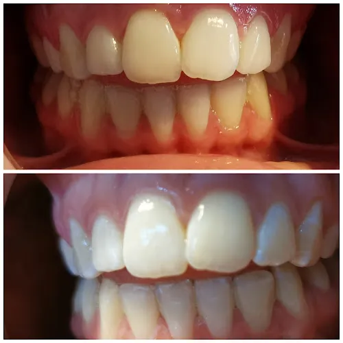 3 - VIP Turkish Barbers