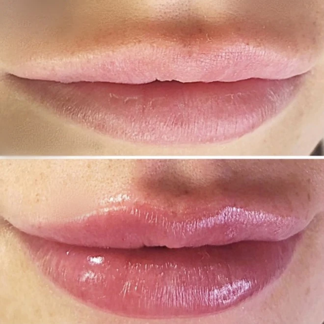 1 - Yorkshire Beauty And Wellness