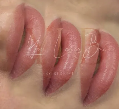 3 - Your Laser Box / Termine nach Absprache